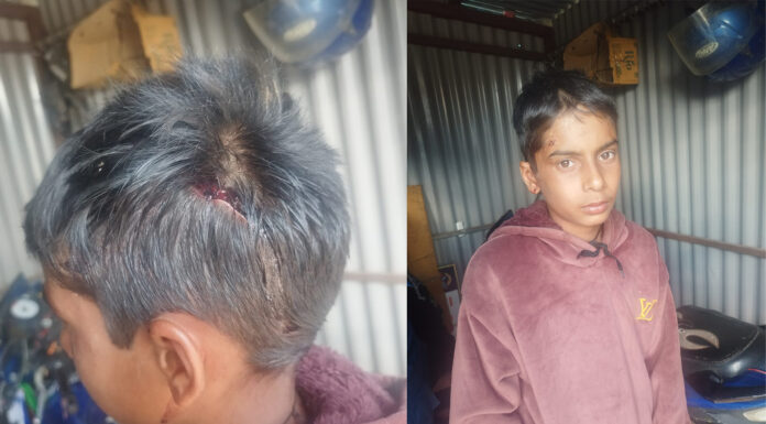 बाघको आक्रमणबाट बैतडीमा १२ वर्षीय बालक घाइते